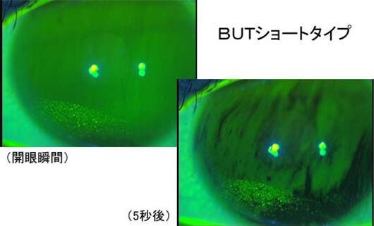 涙の３つの成分