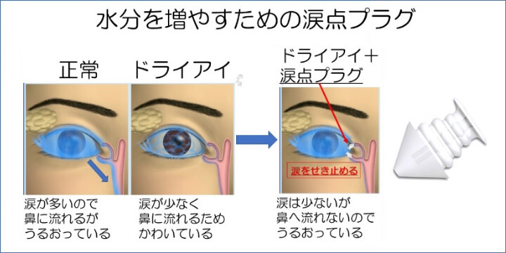 涙の３つの成分