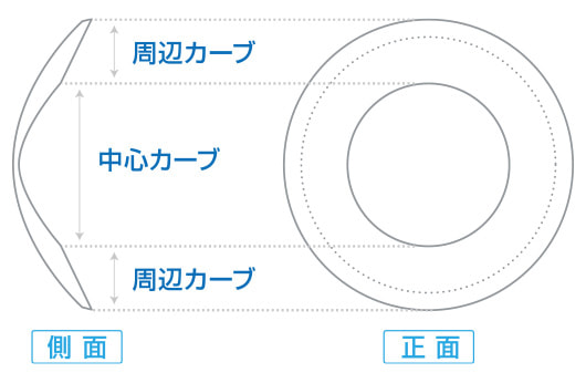 円錐角膜とは