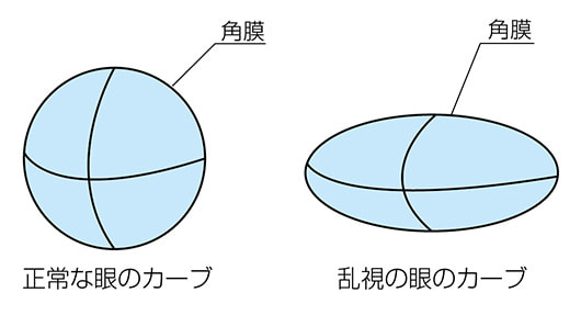 弱視を誘発する。